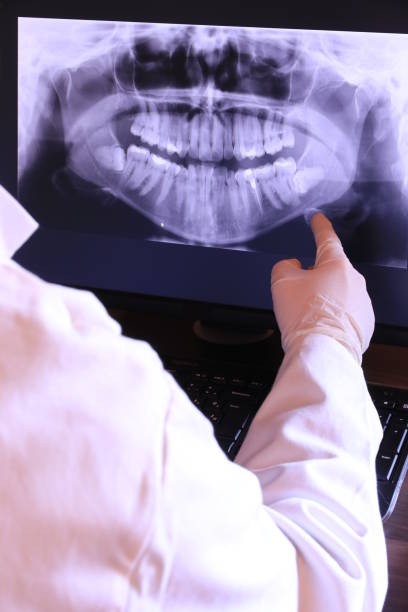 Best Emergency Treatment for Dental Infections or Abscesses in Oceanport, NJ