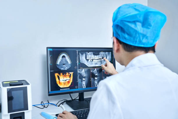 Best Emergency Wisdom Teeth Removal in Oceanport, NJ